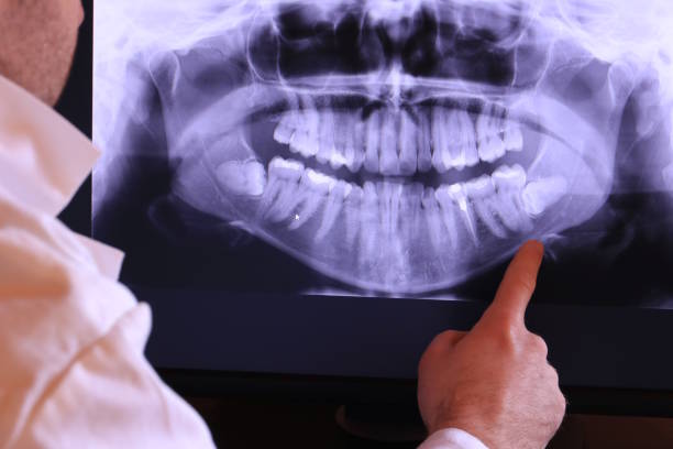 Best Emergency Cosmetic Dentistry in Jamestown West, NY