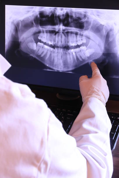 Best Broken or Cracked Tooth Emergency Dentist in Jamestown West, NY