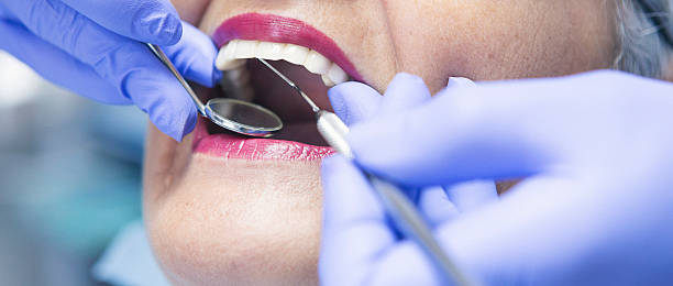 Best Emergency Dental Care for Abscessed Tooth in Jamestown West, NY
